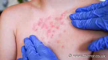 Pharmacist warns 'Victorian' infection making comeback with symptoms to look out for