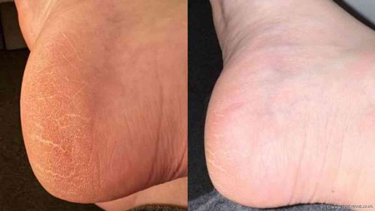 Women swap £40 pedicures for £12 scrub leaving 'feet and legs incredibly soft'