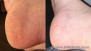 Women swap £40 pedicures for £12 scrub leaving 'feet and legs incredibly soft'