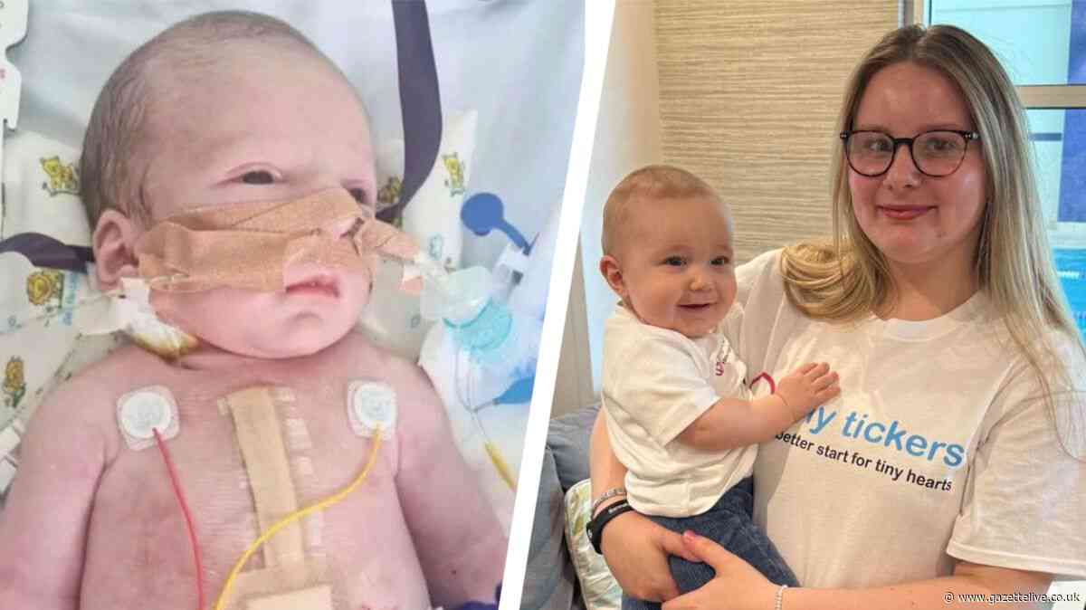 Baby boy born with life-threatening heart condition underwent major surgery at one week old