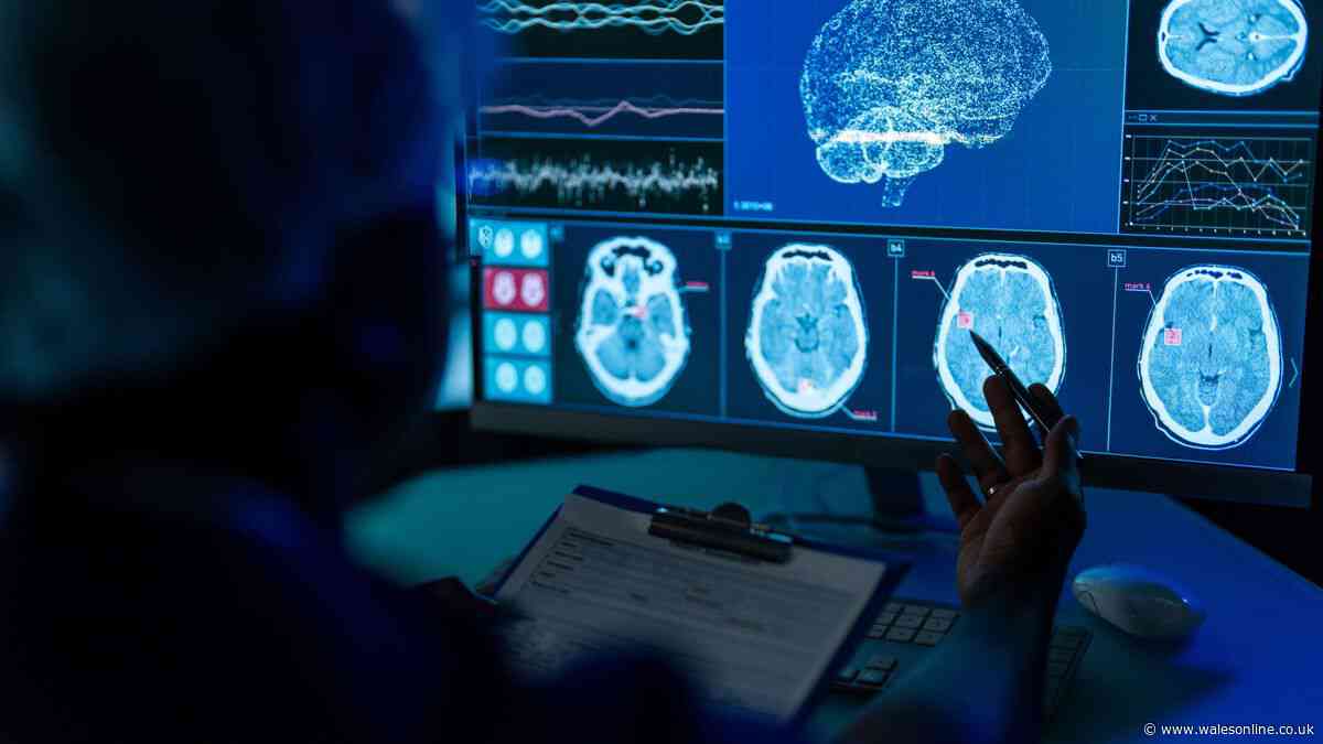 Popular hobby could be key to stroke survivor recovery new research suggests