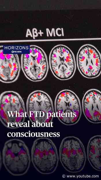 What FTD patients reveal about consciousness