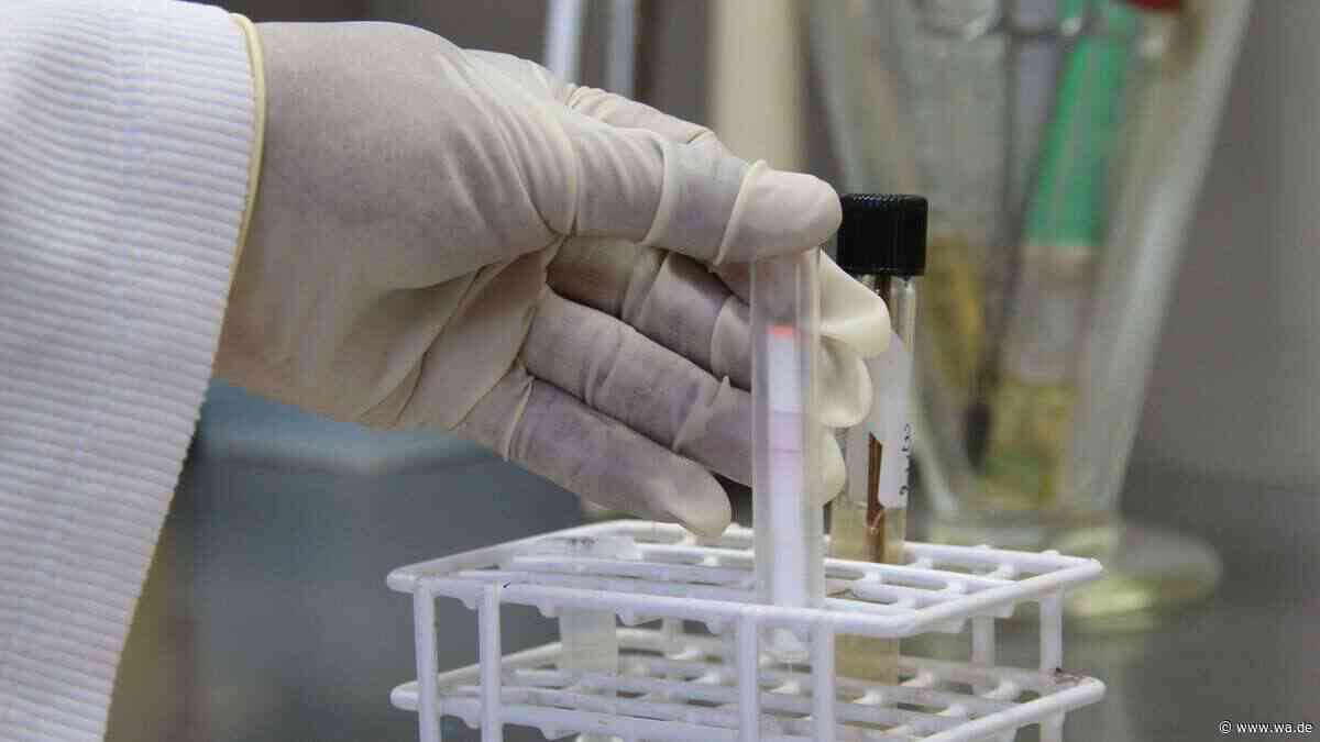 Laborantin stirbt nach Kontakt mit Pest-Bakterium – Behörden sprechen nur von „Lungenentzündung“