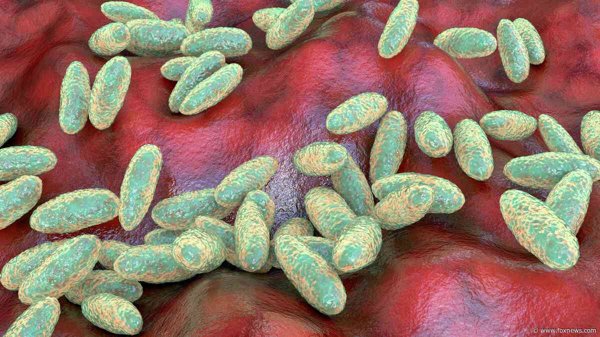 US monitoring suspected fatal pneumonic plague case in Russia, State Department official says