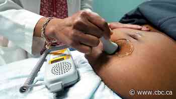 After years of calls for data, study confirms Black Canadians face higher risk of maternal complications