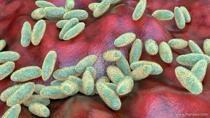 U.S. monitoring suspected fatal pneumonic plague case in Russia, official says