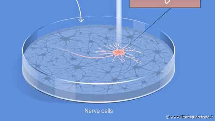 Nobel per la Medicina – Da un’alga che cerca la luce una risposta ai meccanismi del cervello. Cos’è la Chlamydomonas