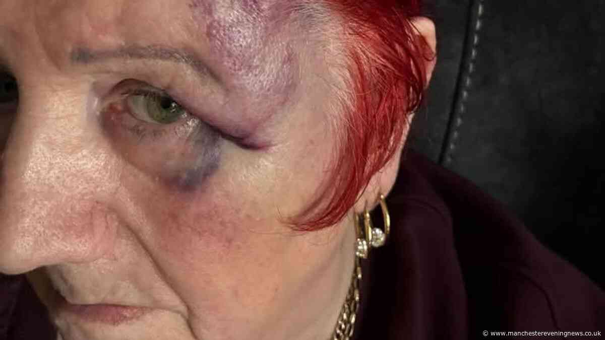 Terrified nan, 82, told 'give us the money' by masked gang who beat her 'black and blue' in home