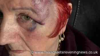 Terrified nan, 82, told 'give us the money' by masked gang who beat her 'black and blue' in home