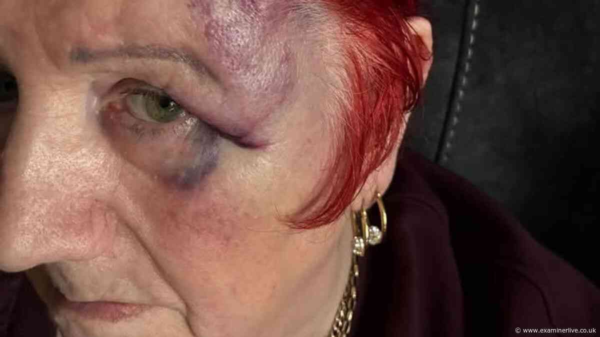 Horror as nan, 82, attacked with an axe inside home by masked gang demanding cash