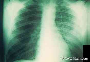 Pneumonic plague: What is it and how dangerous can it be?