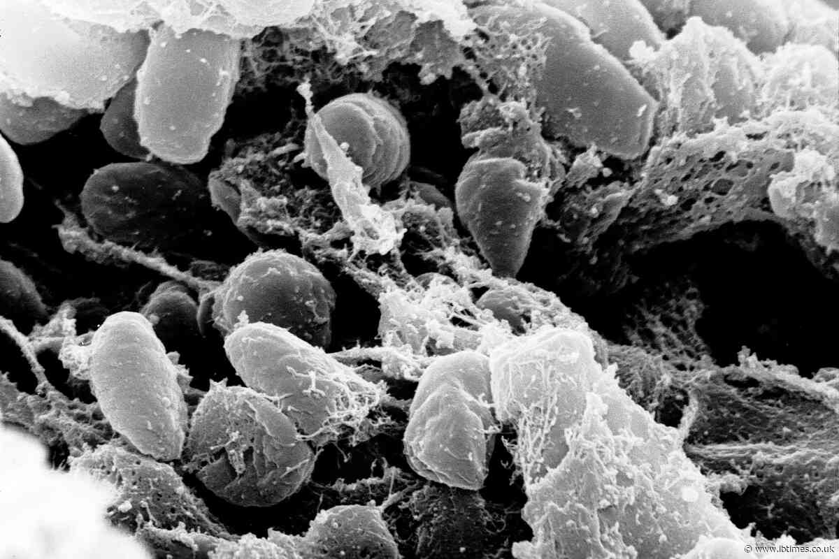 US Monitors Suspected Plague Death Linked to Russian Lab as Officials Investigate Pneumonia Case