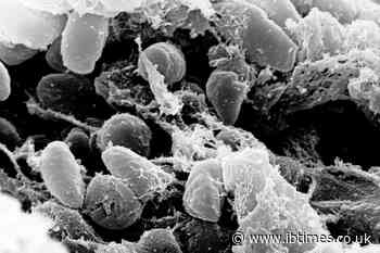 US Monitors Suspected Plague Death Linked to Russian Lab as Officials Investigate Pneumonia Case