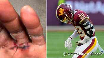 Commanders star posts gruesome locker room photo and claims he almost lost a finger in loss to Colts: 'That's why God gave us 10'