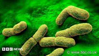 US 'watching closely' after plague researcher dies in Russia