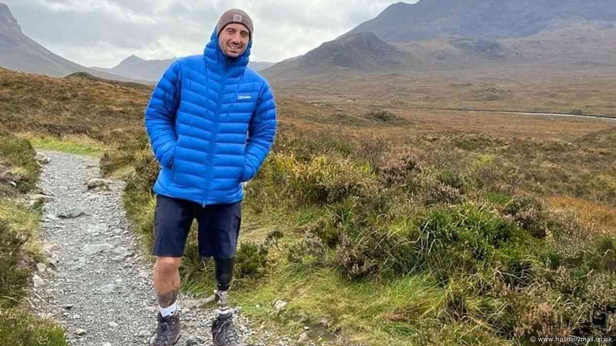 'I lost my life when I didn't die' - Bridlington man who lost leg in bike accident speaks of long road to recovery