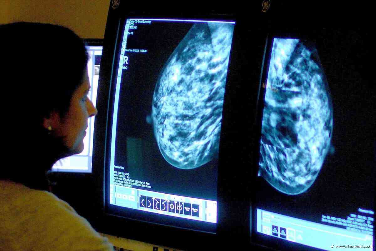 Seven different cancers are rising among under-50s, experts warn