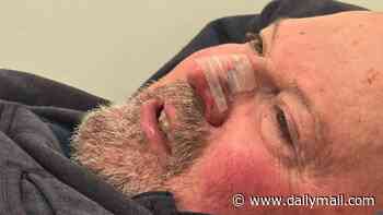 Aussie's warning to check your kitchen after he was injured when a cold can of soup exploded in his face