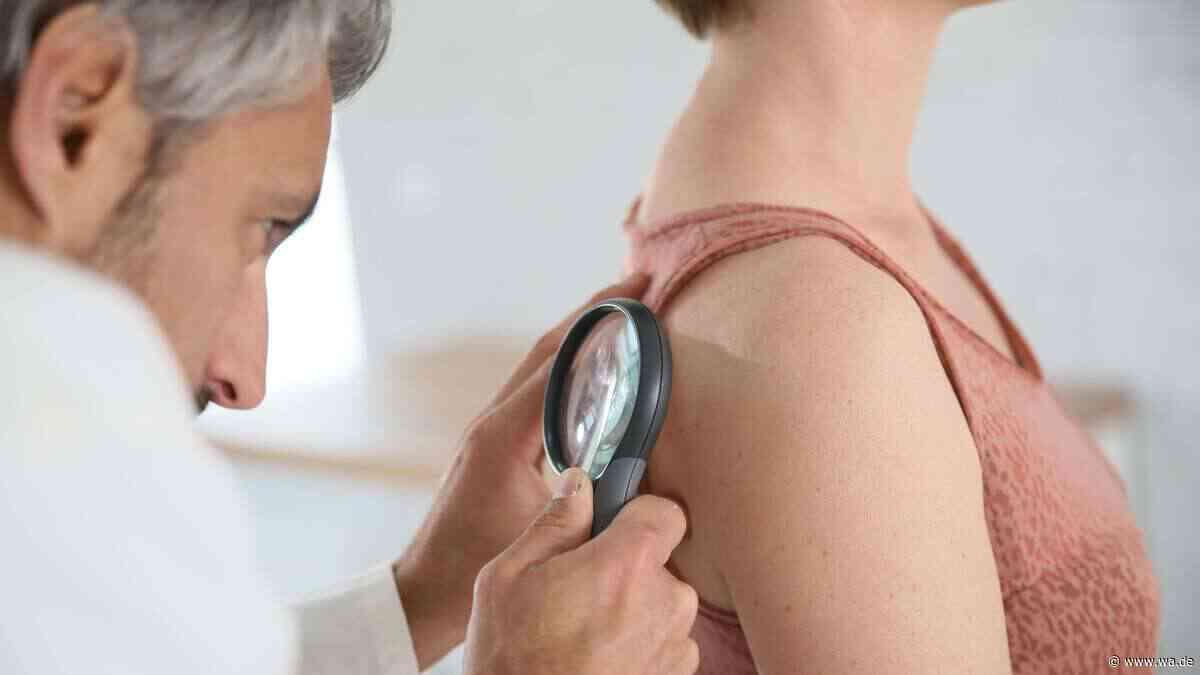 KI prüft verdächtige Muttermale in Minuten – und macht tausende Biopsien überflüssig