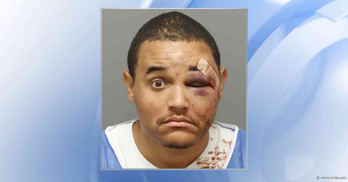 Raleigh detective charged with assault in bar fight