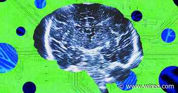A New Neurotech Startup Launches to Rival Sam Altman’s Merge Labs