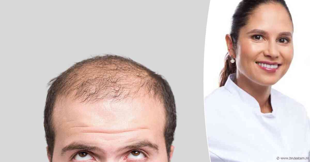 Wil jij weten hoe groot de kans is dat je kaal wordt? Kijk dan naar dit familielid