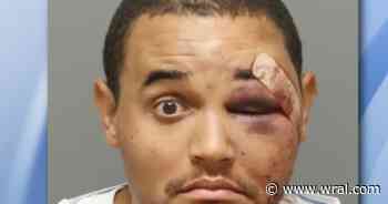 Warrant: Raleigh detective punched a bar manager, kicked a paramedic and told officers to shoot him