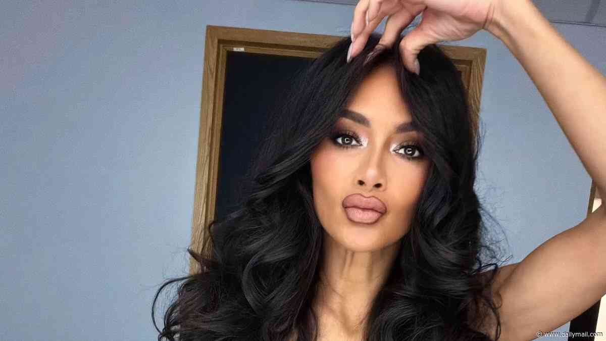 Nicole Scherzinger shares photos of her scarred legs as she gets ready to perform after suffering nasty burns in an accident with boiling water