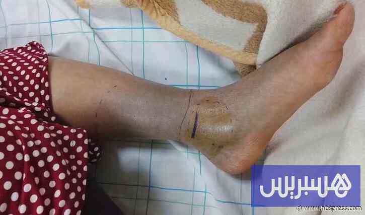 وفاة في طاطا تطرح أزمة الأمصال