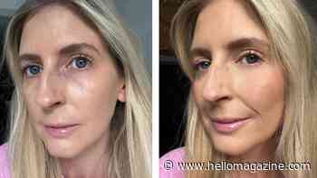 The under-eye concealer mistake that makes you look older – and how to fix it