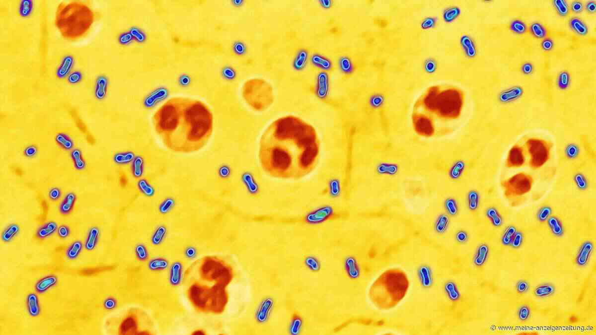 Lungenpest breitet sich per Tröpfchen aus – warum schnelle Diagnose überlebenswichtig ist