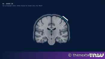 Bridge Neurotech raises $13.5M to read brains with ultrasound, no implant