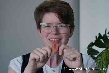 Cancer survivor receives artificial tongue in NHS first