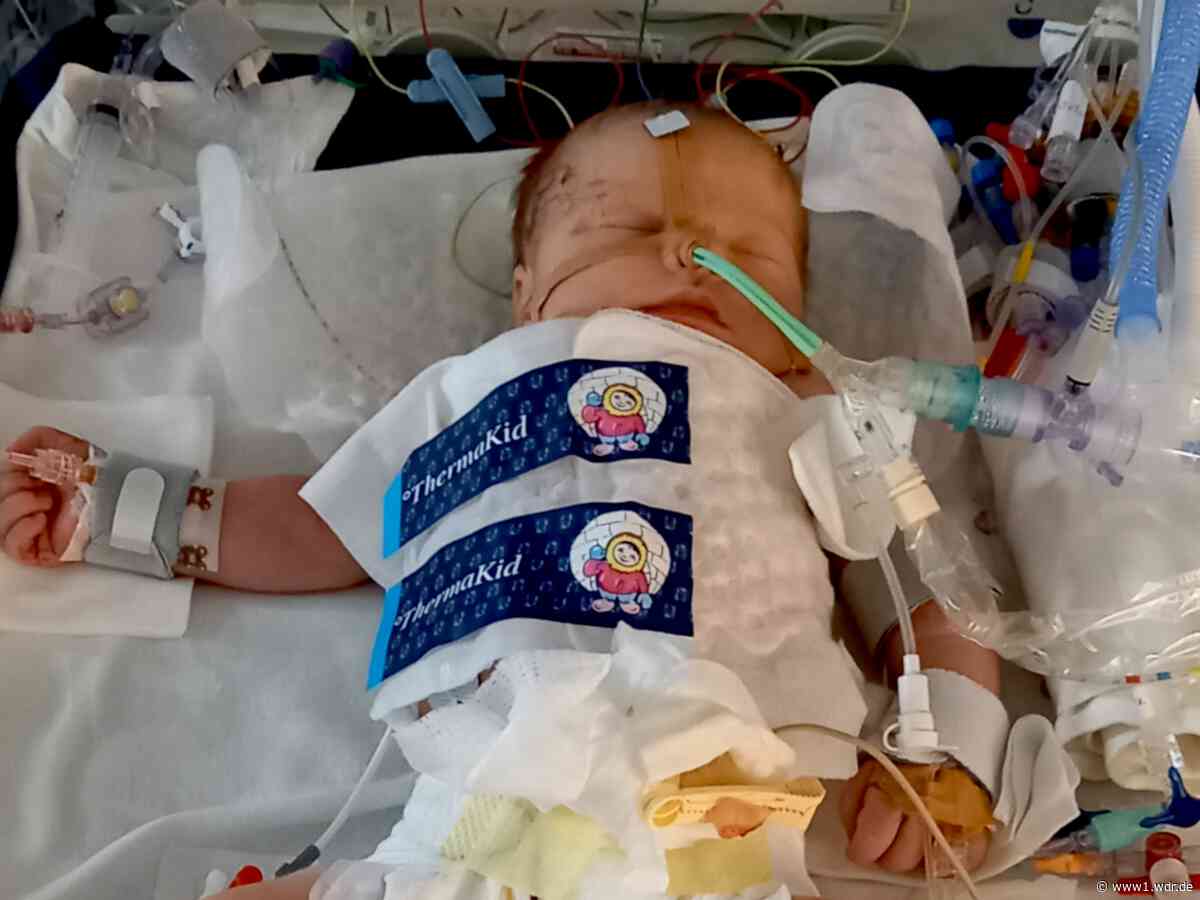 Sauerstoffmangel beim Baby: Hilfe gibt's in Bonn