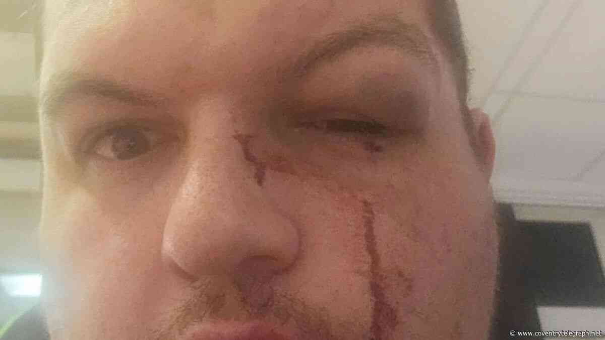Man 'viciously' attacked by thieves - as Coventry community rallies to support him