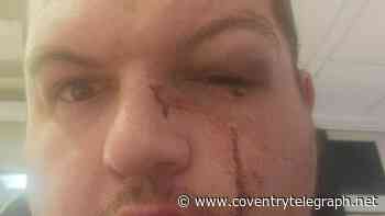 Man 'viciously' attacked by thieves - as Coventry community rallies to support him