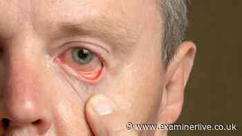 DWP confirms full list of 45 eye conditions that qualify for £114 weekly PIP payment