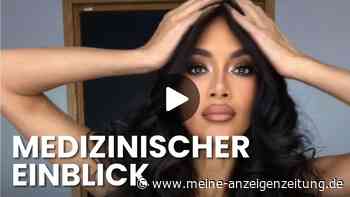 Rötungen sichtbar: Nicole Scherzinger teilt Bilder nach schwerer Verbrühung