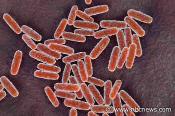 What to know about pneumonic plague after woman in Russia dies from mysterious illness