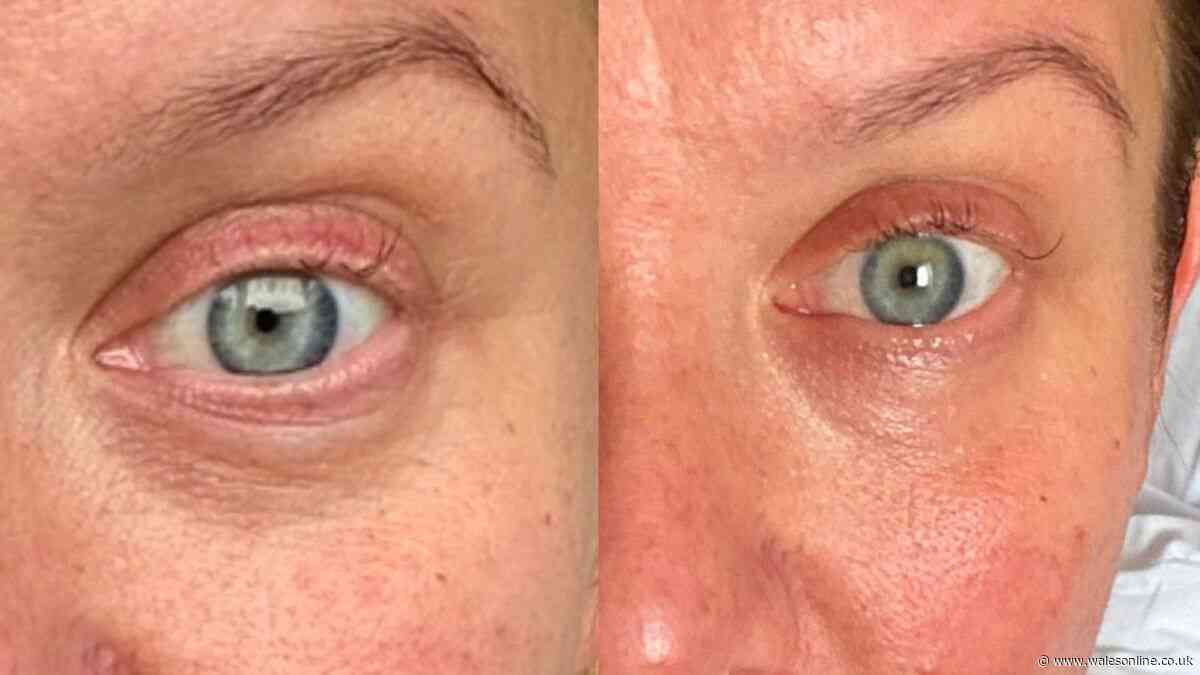 'Magic potion' anti-ageing cream that 'leaves skin tighter in a few uses' now £22