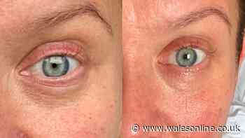 'Magic potion' anti-ageing cream that 'leaves skin tighter in a few uses' now £22