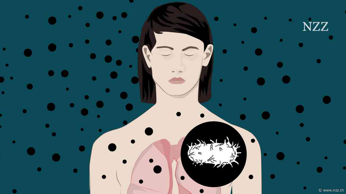 ERKLÄRT - Wie häufig sind Infektionen mit der Pest im Labor? Warum wird überhaupt an dem Erreger geforscht?