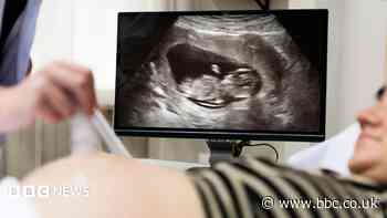 Head of maternity review says 'we will listen to parents'