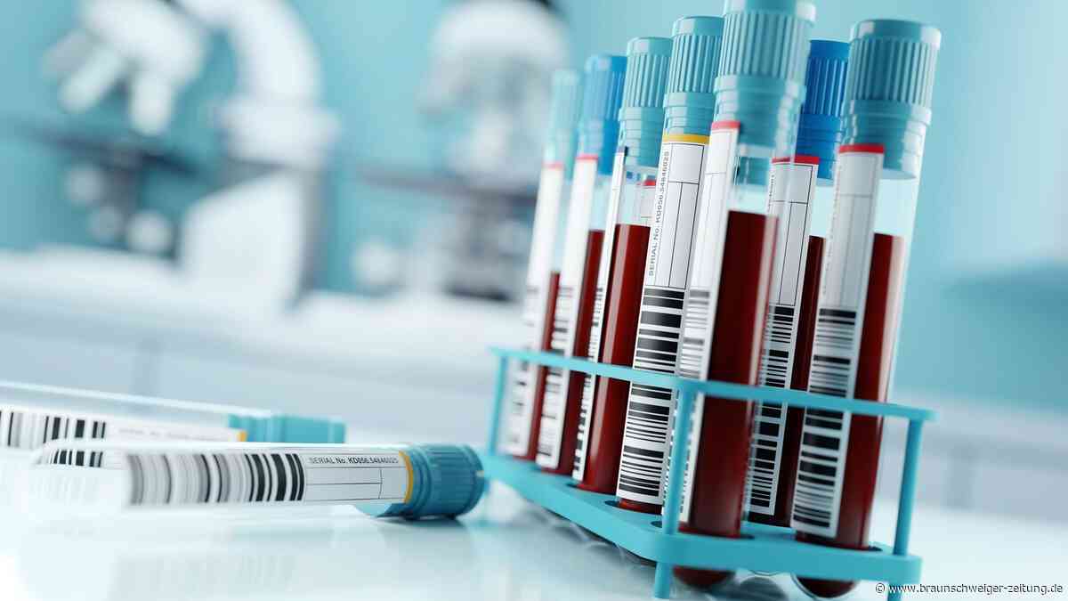 NIPT: Ob sich Eltern für einen Test entscheiden, darf nicht vom Geldbeutel abhängen