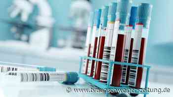NIPT: Ob sich Eltern für einen Test entscheiden, darf nicht vom Geldbeutel abhängen