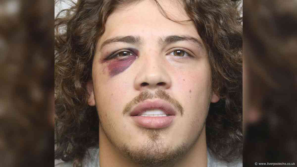 Skelmersdale man, 21, with black eye is jailed after being spotted swallowing mobile phone