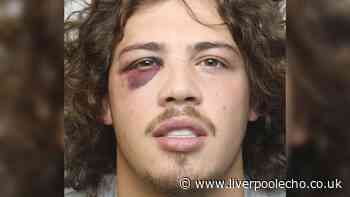 Skelmersdale man, 21, with black eye is jailed after being spotted swallowing mobile phone