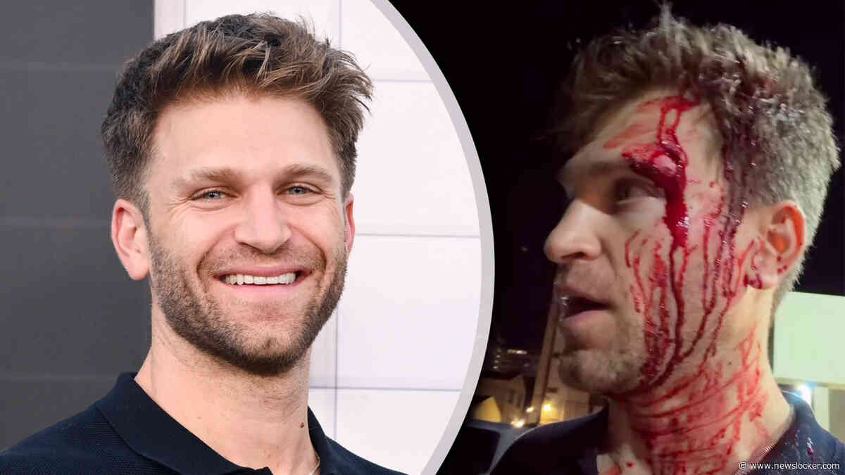 ’Pretty little liars’-ster Keegan Allen (37) slachtoffer brute overval: ’Twee gasten sloegen me op mijn hoofd en richtten een pistool op me’