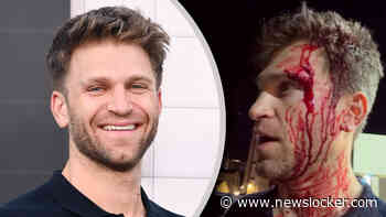’Pretty little liars’-ster Keegan Allen (37) slachtoffer brute overval: ’Twee gasten sloegen me op mijn hoofd en richtten een pistool op me’