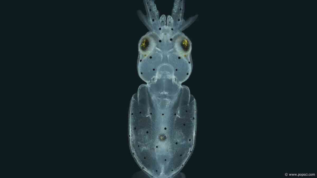 Squid are covered in little hairs like the ones in your ear